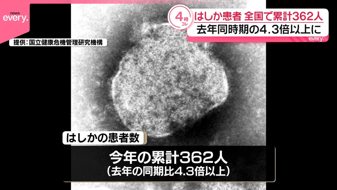はしか】全国患者数ことし累計362人で 去年同時期の4.3倍以上に - YouTube