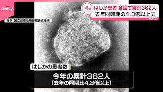 【はしか】全国患者数ことし累計362人で  去年同時期の4.3倍以上に