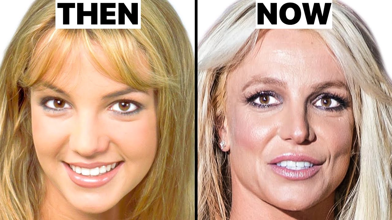 Britney Spears NEW FACE | Plastic Surgery Analysis - YouTube