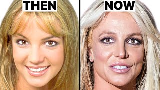 Britney Spears NEW FACE | Plastic Surgery Analysis