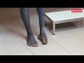 Kaya/Burkina Faso : Dr Marius Nézien développe une expertise afin de sauver des vies