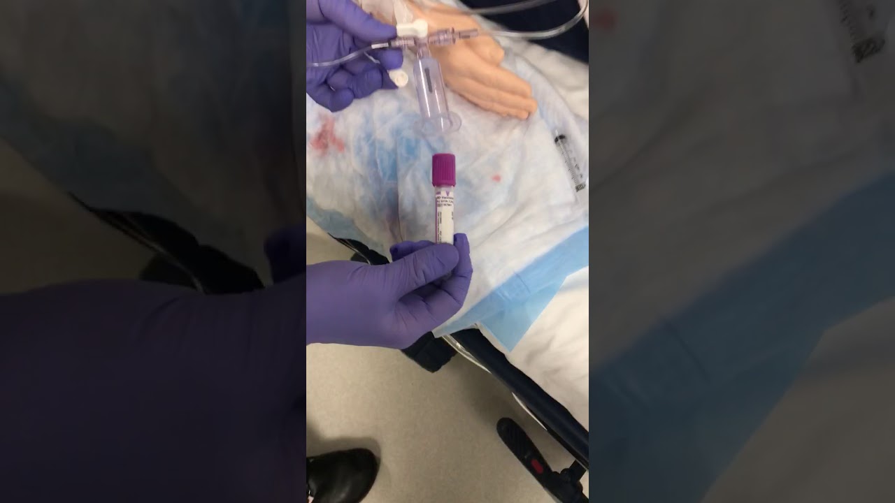 Art line hooked to monitor, zero and drawing blood