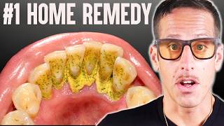 #1 Best Remedy That Removes Tartar & Plaque FAST