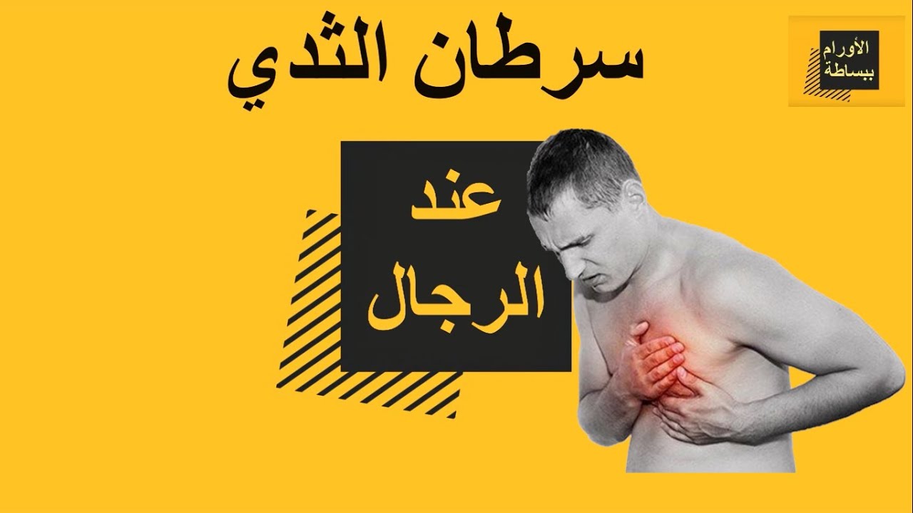 سرطان الثدي عند الرجال