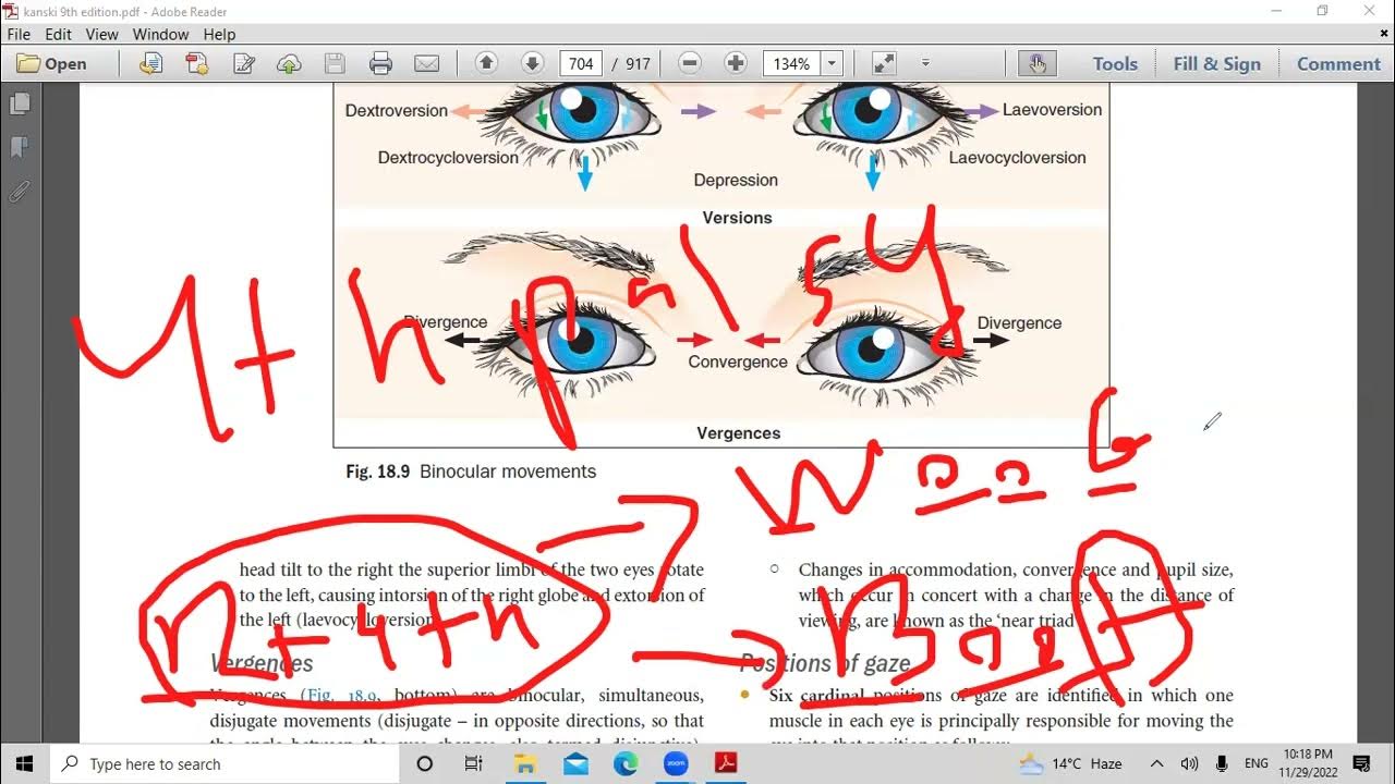 second lecture in strabismus YouTube