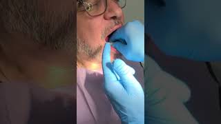 Upper & lower suction and an initial set of dentures by Dimitry Shmitsman, RD. CDT.