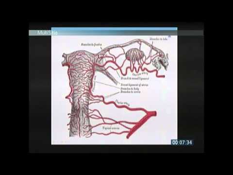 Video: Fiziopatologia Coagulopatiei Induse De Traume: Coagulare Intravasculară Diseminată Cu Fenotipul Fibrinolitic