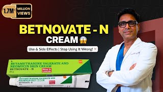 Dr. Shail Gupta Reveals The Truth About Betnovate N Cream Side Effects