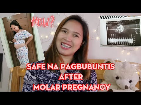 Video: Paano Makitungo sa Pagbubuntis ng Molar: 8 Hakbang (na may Mga Larawan)