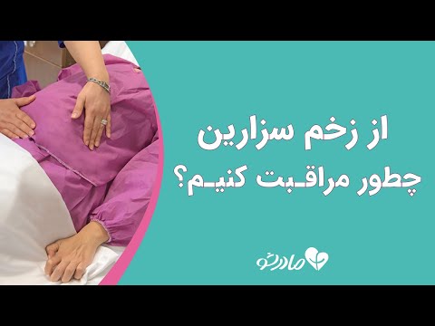 تصویری: انجام چند سزارین بی خطر است؟