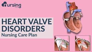 How heart valve disorders occur and caring for heart valve disorders (Nursing Care Plan)