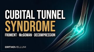 Cubital Tunnel Syndrome Masterclass: Ulnar Nerve Compression at the Elbow