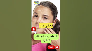 تخلصي من حروق الشمس وتصبغات البشرة في أسبوع واحد 