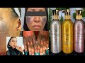 ASIAN WHITE LOTION FOR SKIN WHITENING AND SKIN REPAIR | CLEAR STRETCH MARKS,SUNBURN AND SKIN ISSUES