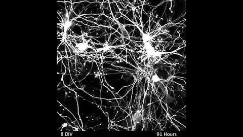 Neuron time lapse video