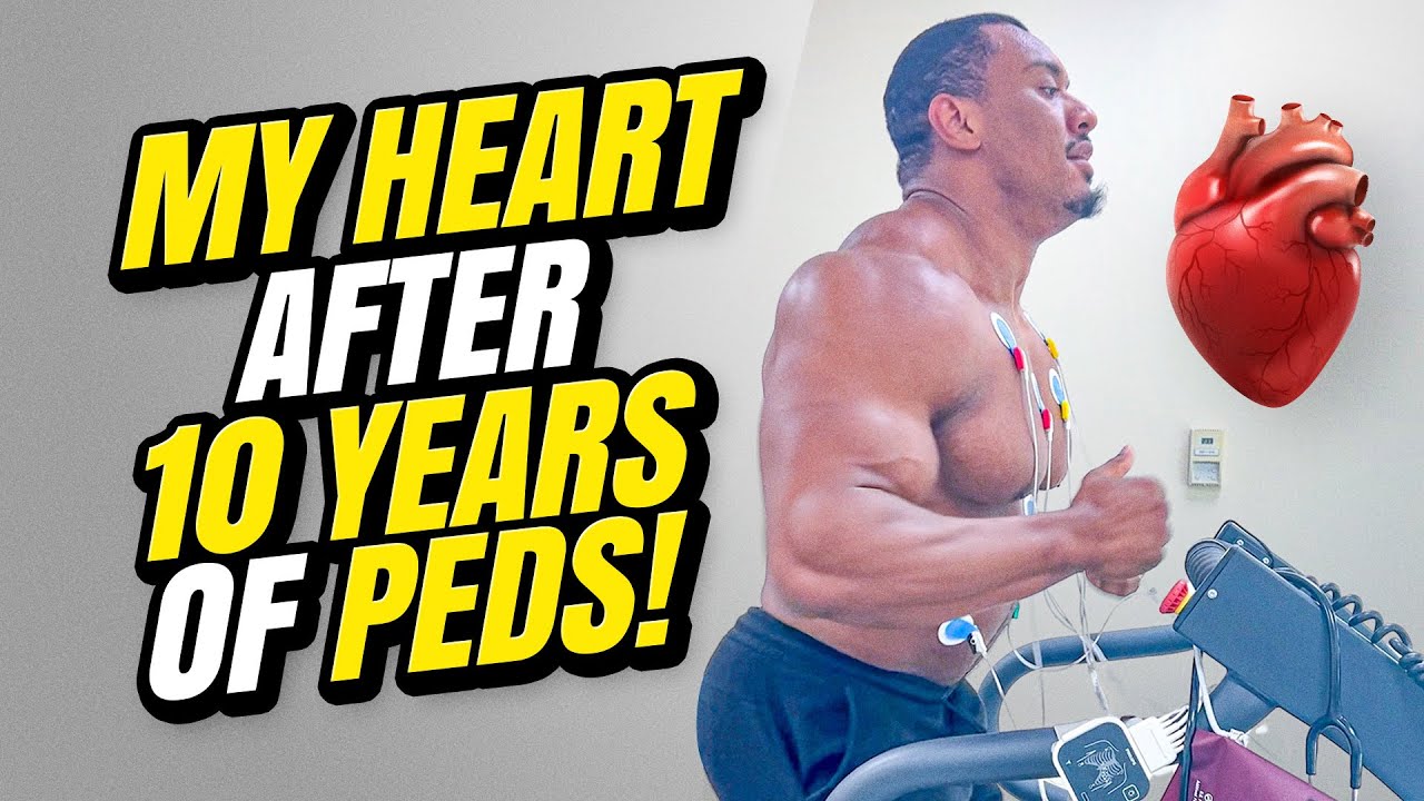 МОЕ СЕРДЦЕ ПОСЛЕ 10 ЛЕТ ПРИЕМА ПРЕПАРАТОВ