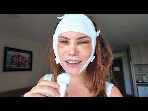 I had to go back to Japan with my face looking like this...