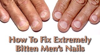 How To Fix Ultra Short, Bitten Nails. A Technique Every Manicurist Need To Master. ENG.