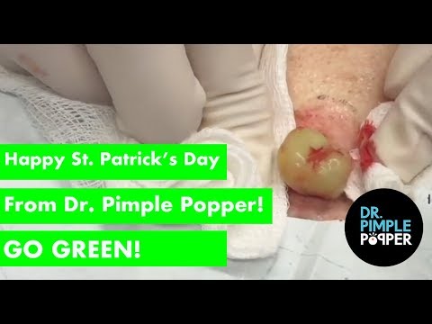 Happy St Patrick's Day From Dr Pimple Popper! Go GREEN!
