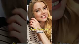 11 Celebrities Who Changed Their Appearance After Gaining Fame #facts #hollywood#celebrity