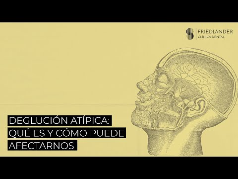 Vídeo: Què és la comunicació atípica?