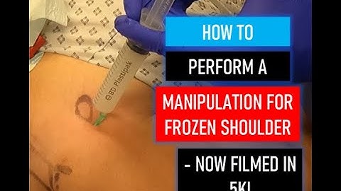 ELECTIVE: How to perform a Manipulation Under Anaesthetic for Frozen Shoulder