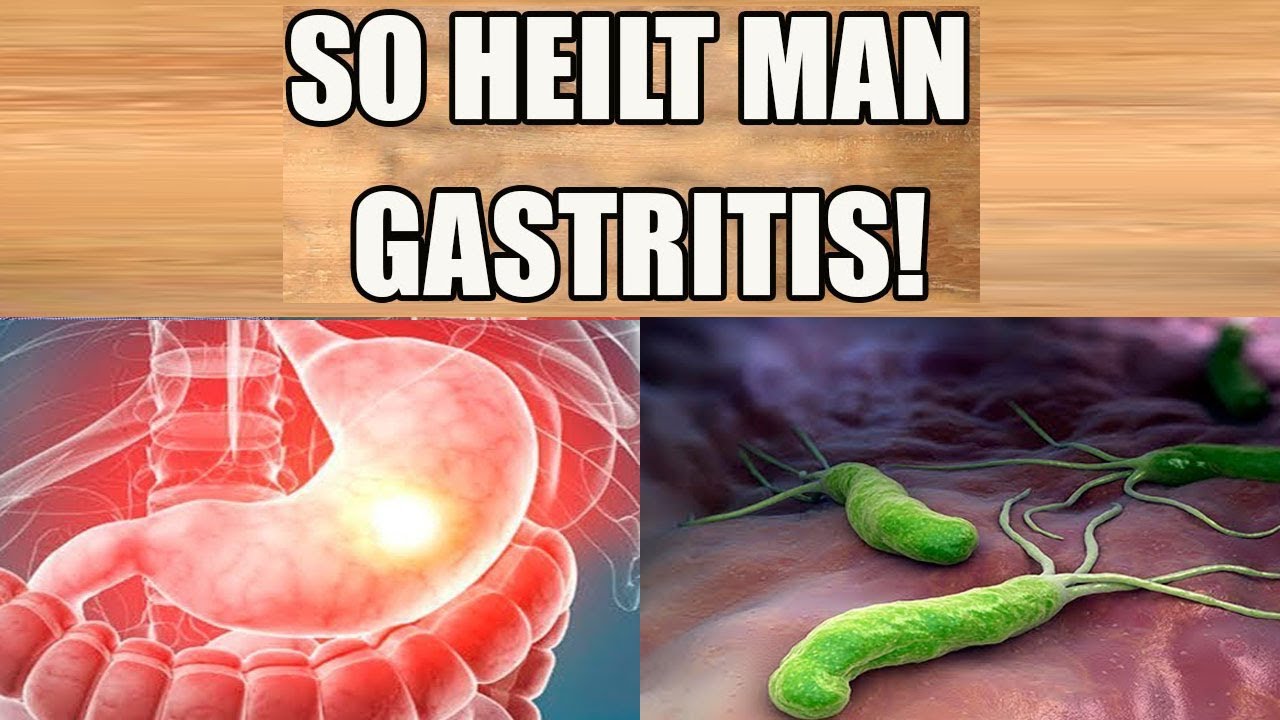 Gastritis heilen Beseitige deine Gastritis schnell und natürlich