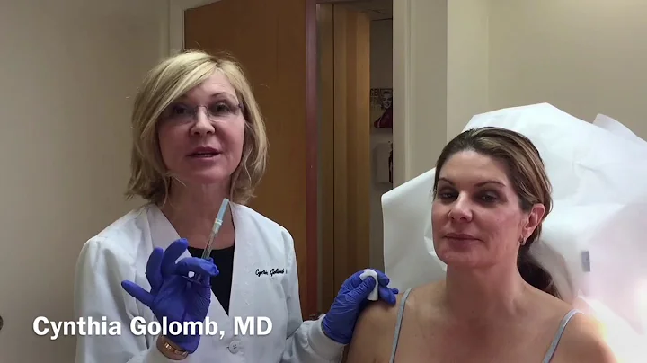 Vollure filler gives lift