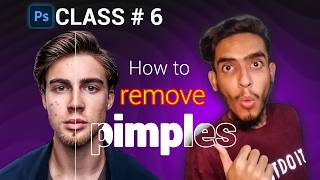 How to remove pimples and any object, healing brush tool, Spot healing brush tool, patch tool