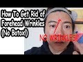 How To Get Rid of Forehead Wrinkles (No Botox!)