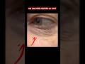 Did This Ever Happen To You? #shorts #healthtips #eyes #healthandwellnessforseniors #eyewellness