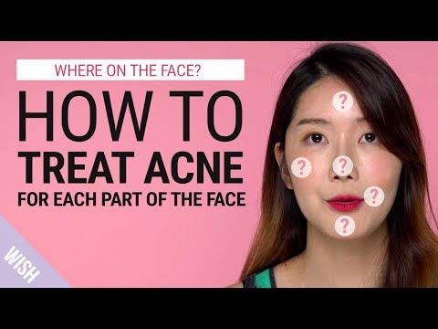 Acne  | Different Acne Meaning According to Different Parts of the Face | Wish Beauty 