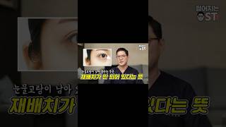 눈밑지방재배치 부작용 실패 원인은 5가지입니다 (유형별 해결책)