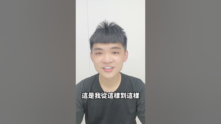 頭皮癢 甚至還長痘的我 救星來了~~~