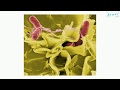 Salmonella (English) - Medical terminology for medical students -