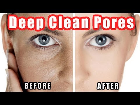 How to Clean Pores - Deep Cleaning Your Pores on Nose + Face Easily