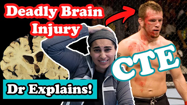 What is Chronic Traumatic Encephalopathy (CTE)? Spencer Fisher UFC BRAIN INJURY | (Doctor Explains)