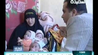 ولادة نادرة   إمرأة يمنية تضع اربعة اطفال