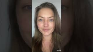 My first time getting “Botox” (botulinum toxin) before/after #shorts #botulinumtoxin #injector