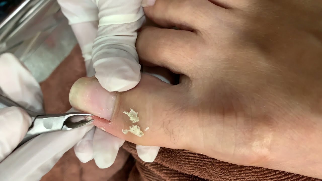 How to Repair Nails easy 330 YouTube