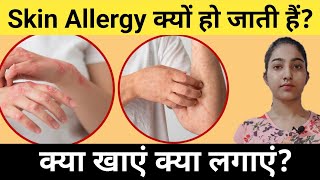 Skin Allergy क्यों हो जाती है?|क्या खाएं क्या लगाएं?|Alka Thakur