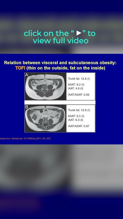 are-you-a-tofi-thin-on-the-outside-fat-on-the-inside-intra