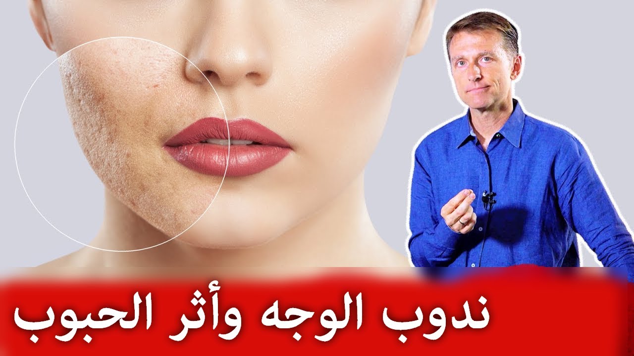 استخدموا هذا الزيت للتخلص بفعالية من ندوب الجلد وآثار حب الشباب