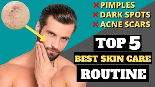 Top 5 Easy and Best Skin care Routine| Easy solution for pimple, Dark Spots, and Acne Removal