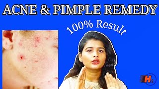 Pimples & Acne Home Remedy in tamil |How to Remove Pimples |பருக்கள் நீக்குவது எப்படி  |H2