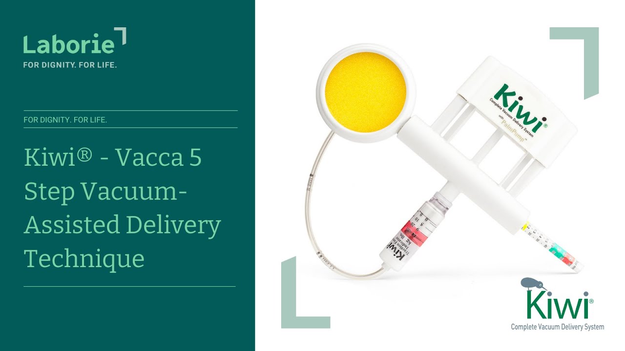 Kiwi® - Vacca 5-Step Vacuum-Assisted Delivery Technique | Complete Guide