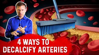 4 Ways To Decalcify Your Arteries – Dr. Berg screenshot 3