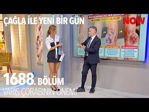 Bileğinizi Korumak İçin Varis Çorabı Giyin - Çağla ile Yeni Bir Gün 1688. Bölüm @CaglaileYeniBirGun​