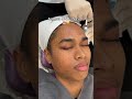 Would YOU try this treatment? 💉👀