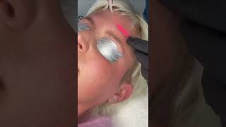 Amazing Eyebrow Tattoo Removal ⚡️⚡️⚡️